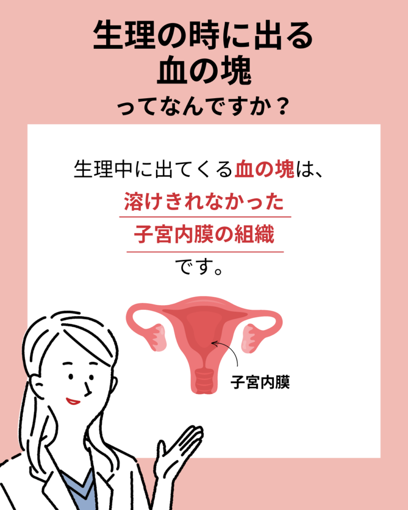 生理の時に出る血の塊ってなんですか?
生理中にでてくる血の塊は。溶けきれなかった子宮内膜の組織です。